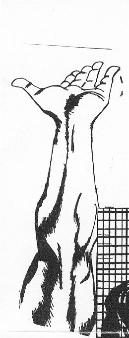 Arm